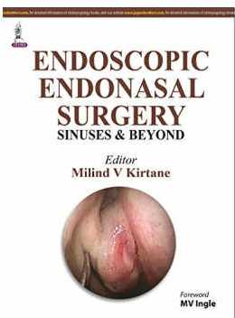 Endoscopic Endonasal Surgery Sinuses And Beyond